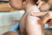 17 Common Skin Rashes in Children