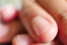 What These 9 Fingernail Signs Say About Your Health