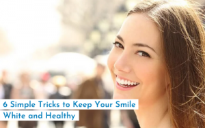 Simple Tricks to Keep Your Smile White and Healthy 